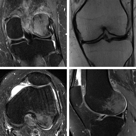 Musculoskeletal Clinical Case Of The Month - SONK | London Bridge ...