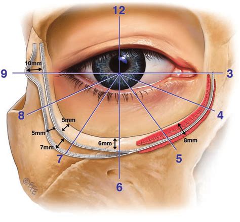 release   tear trough orbicularis retaining ligament complex