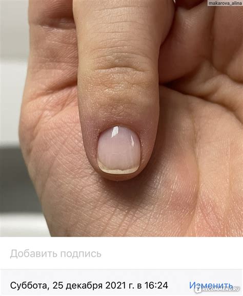 Сыворотка для ногтей Orto Doc Nail Growth Serum - «Лучше, чем ожидала ...
