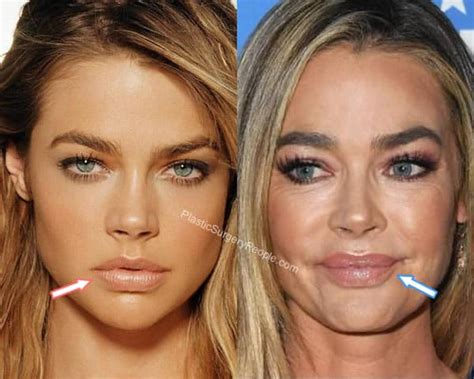 Denise Richards: BEFORE and AFTER 2019