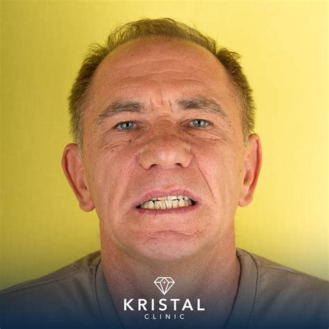 Gallery Kristal Clinic