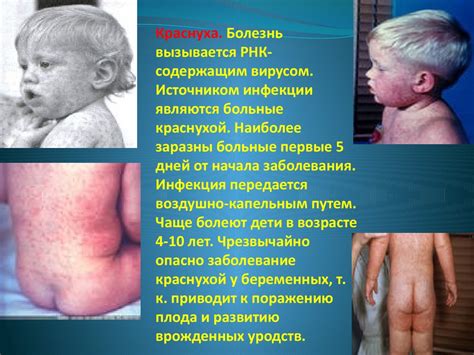 Вирусы - возбудители заболеваний - презентация онлайн