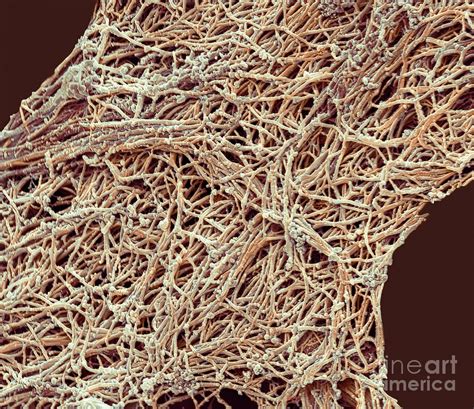 Collagen Fibres Photograph by Steve Gschmeissner/science Photo Library ...