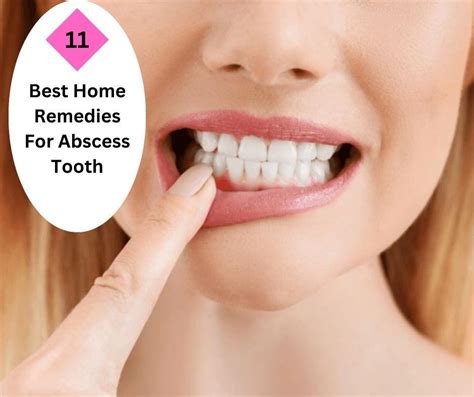 11 Best Home Remedies For Abscess Tooth | Fabbon