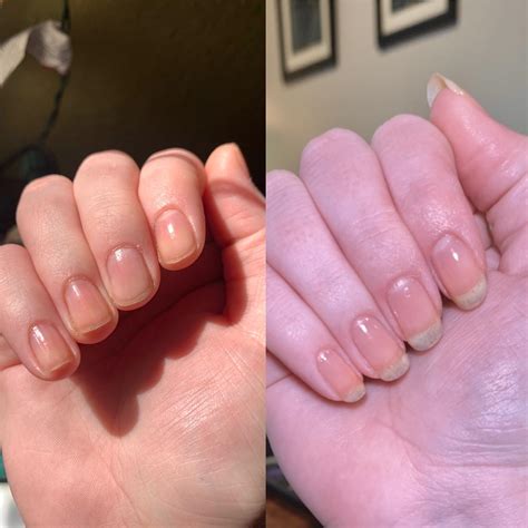 Nail Growth Timeline at Angela Bates blog