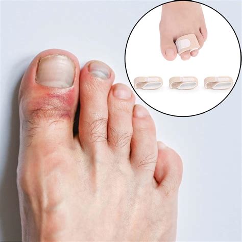 14 PCS Hammer Toe Straightener with Toe Ring Design - Correct Crooked