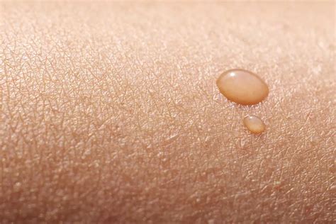 structure  fonctions de la peau fmedic