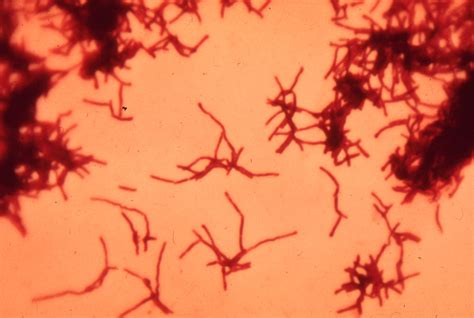 actinomycetes environmental information