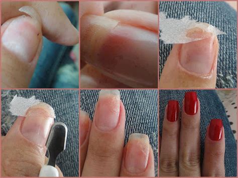 O Que Fazer Quando As Unhas Quebram - Menina mimada : O que devo fazer quando minha unha quebra?