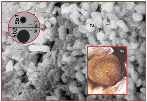 UREAPLASMA UREALYTICUM | Dirt and More Dirt