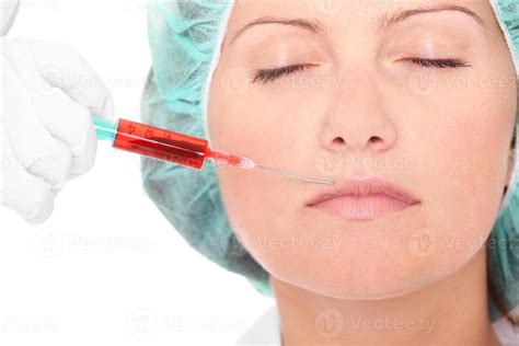 Lip enhancement treatment 16583014 Stock Photo at Vecteezy