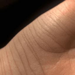 Why is My Skin Sensitive to Touch All of a Sudden - Telesup.net