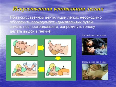 Оказание первой доврачебной помощи - презентация онлайн