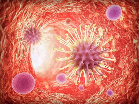 Viral Infection