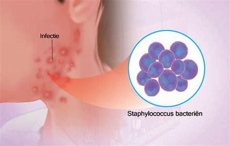 Health Condition : Symptoms, Causes, Treatment and More