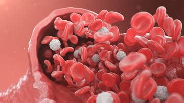 aortic diseases uchicago medicine