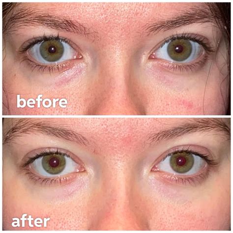 castor oil before & after - 1 week results : r/beauty