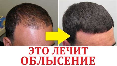 Дива Маск Маска Для Волос, Diva Mask Для Волос Цена, Diva Mask Для ...