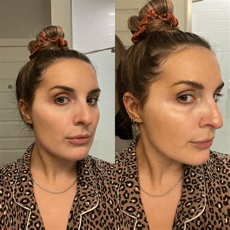 I Used Snail Mucin on My Face for Two Weeks—Here’s What It Did for My