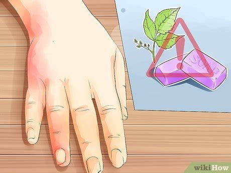 6 Ways to Treat Dermatitis - wikiHow Health