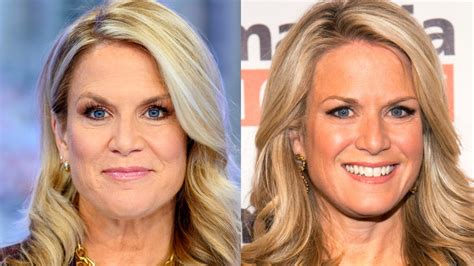 Fox News' Martha MacCallum Can't Escape Plastic Surgery Rumors