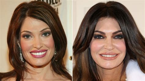 The Curious Case Of Kimberly Guilfoyles Face Transformation From Scandal To Sculpted Renewal