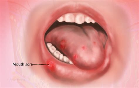 Health Condition : Symptoms, Causes, Treatment and More