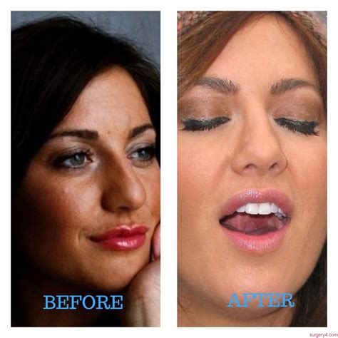 Patricia Heaton Plastic Surgery Photos [Before & After] - Surgery4