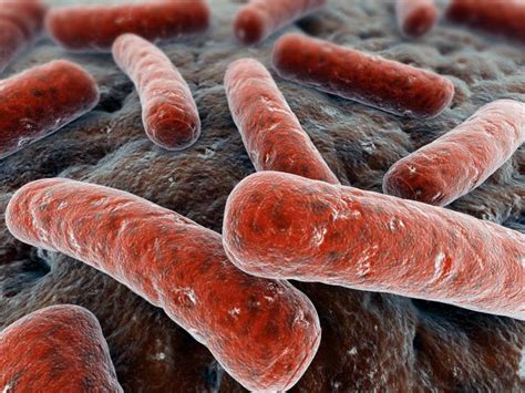 Što je tuberkuloza? Analiza za tuberkulozu. Prvi simptomi tuberkuloze