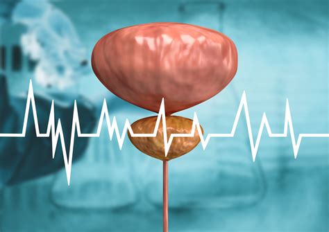 simple prostatectomy  urology fl