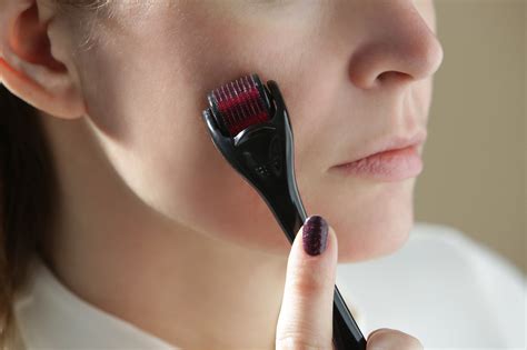 How to Bring a Pimple to a Head Quickly and Safely | Rael