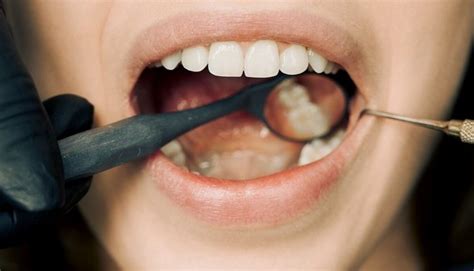 penyebab umum sakit gigi  perlu kamu waspadai