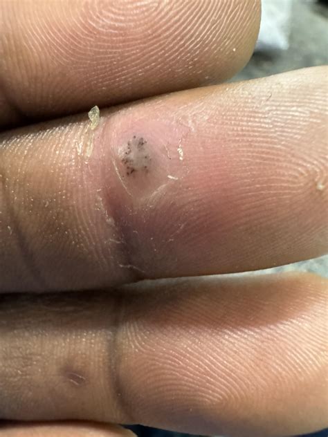 So I used eyebrow razor to remove the white stuff and it’s started to