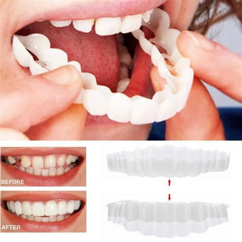 2 шт. набор подтяжек для зубов Smile Denture косметика для зубов ...