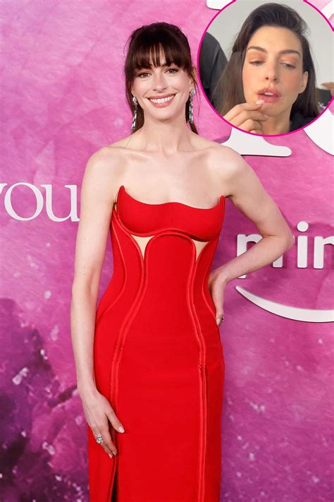 Anne Hathaway’s Secret to Having Perfectly Plump Lips Involves the Use
