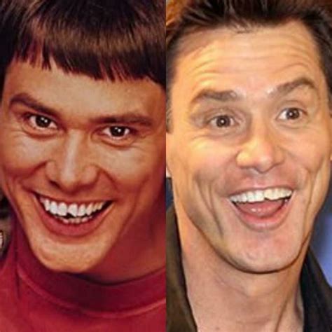 jim carrey chipped tooth