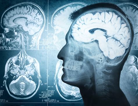 A Pain in the Brain?