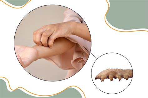 Demodex Mites: Secrets & Best Treatment | Ungex