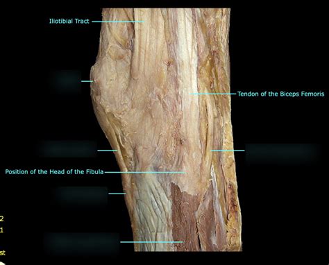lateral fibular collateral ligament diagram quizlet