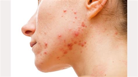 Skin Problems: अब स्मार्टफोन से स्किन की बीमारियों का चलेगा पता, एम्स ...
