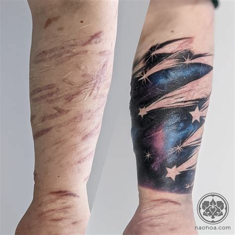 Can you tattoo over keloid scars photos - Wisconsintattoocompany.com