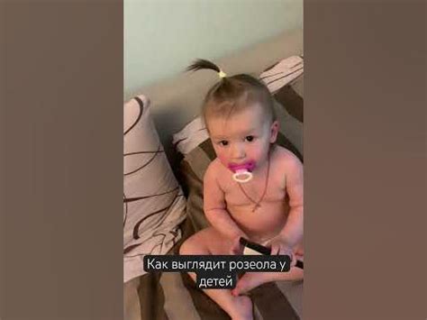 Как выглядит розеола у детей? #дочь #мамаималыш #детивидео #розеола ...