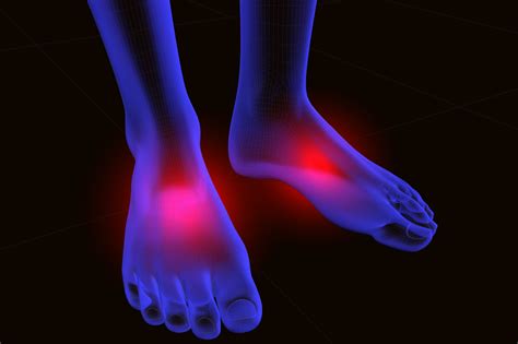 Nerve Disorders | Neuromas & Neuropathy Treatment | Foot Doctors Irwin