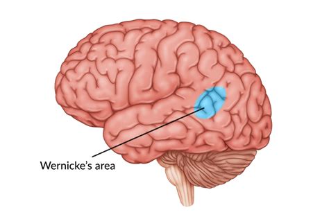 Damage to Wernicke's Area: Symptoms & Stages of Recovery