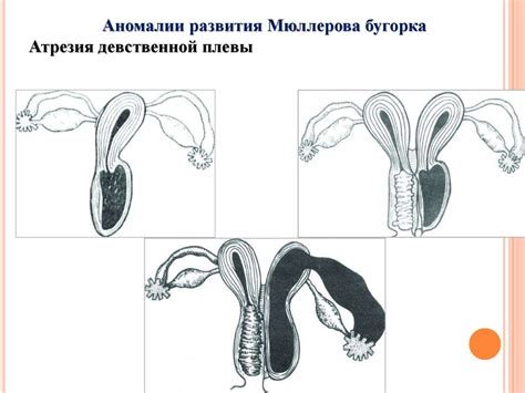 Развитие половой системы - презентация онлайн