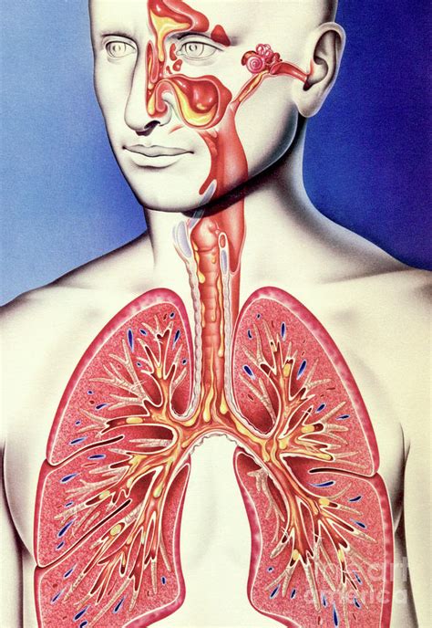 Upper And Lower Respiratory Tract Infections Photograph by John Bavosi ...