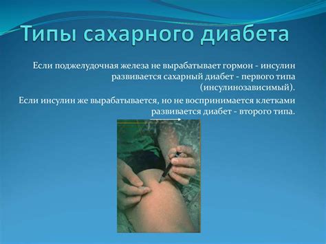 Обмен веществ. Виды обмена веществ - презентация онлайн