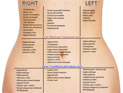 abdominal pain differential diagnosis based  location
