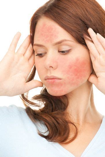 red sensitive skin artofit