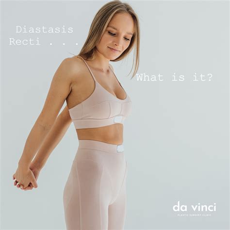 Da Vinci Clinic - Diastasis Recti. More common than you...